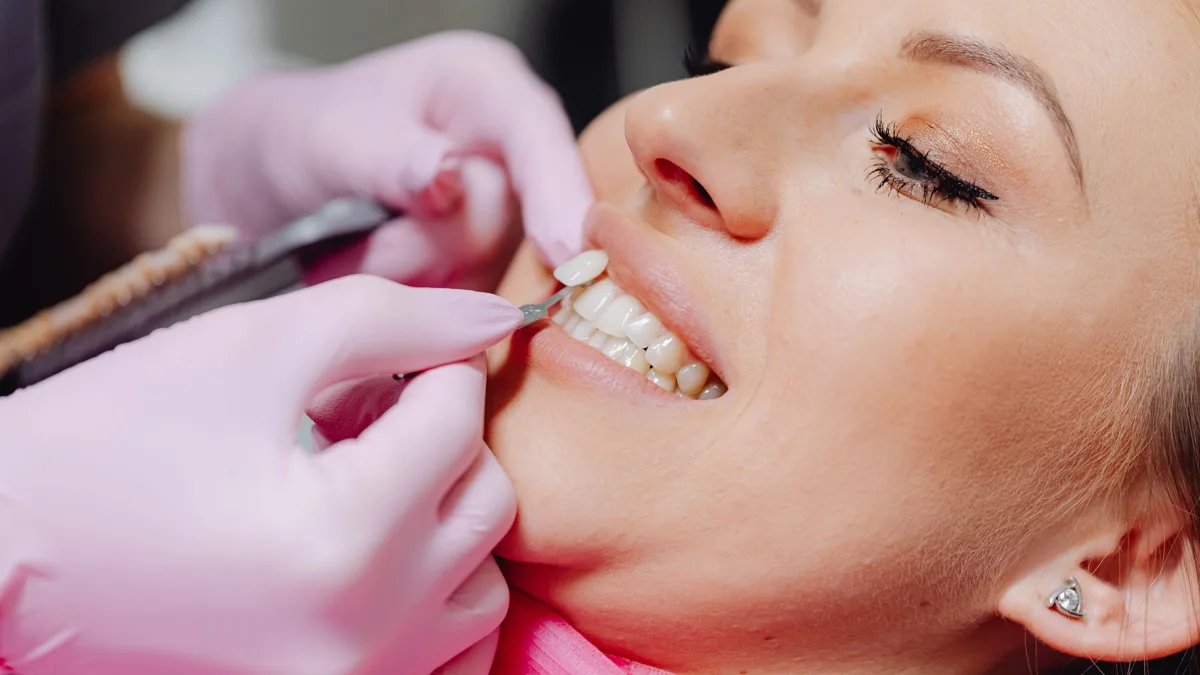 Dents résine Capdentaire : prix, pose et limites